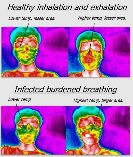 breath pattern analysis